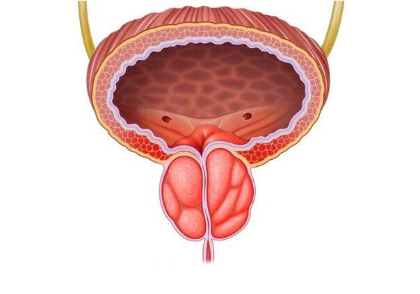 Tratamento da prostatite en homes